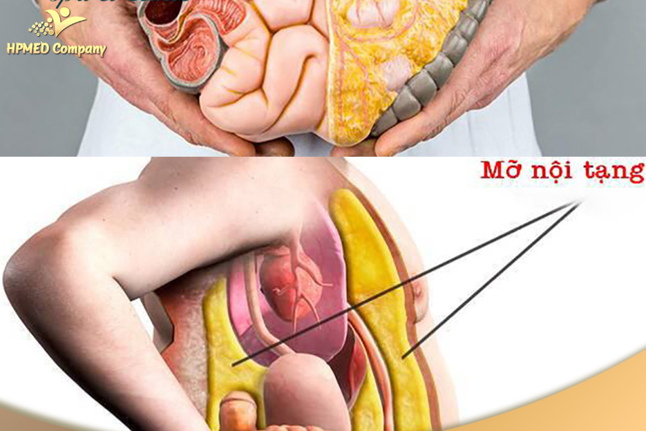 cách đào thải mỡ nội tạng nào hiệu quả an toàn 5 17 1