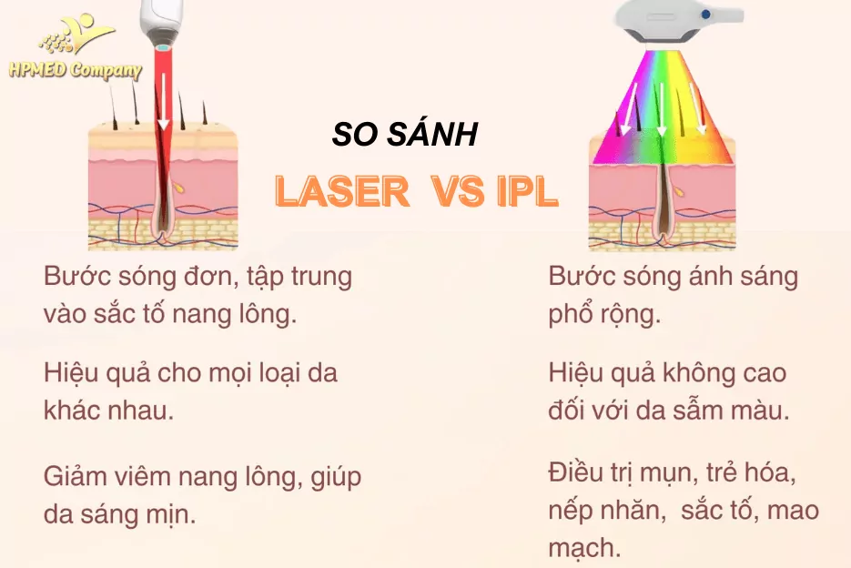 So sánh Công nghệ IPL và Diode Laser