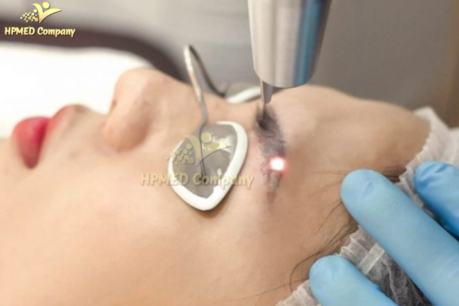 Máy Laser Xoá Xăm Chân Mày: Hiệu Quả & Giá Cả 2025 4 Máy Laser Xoá Xăm