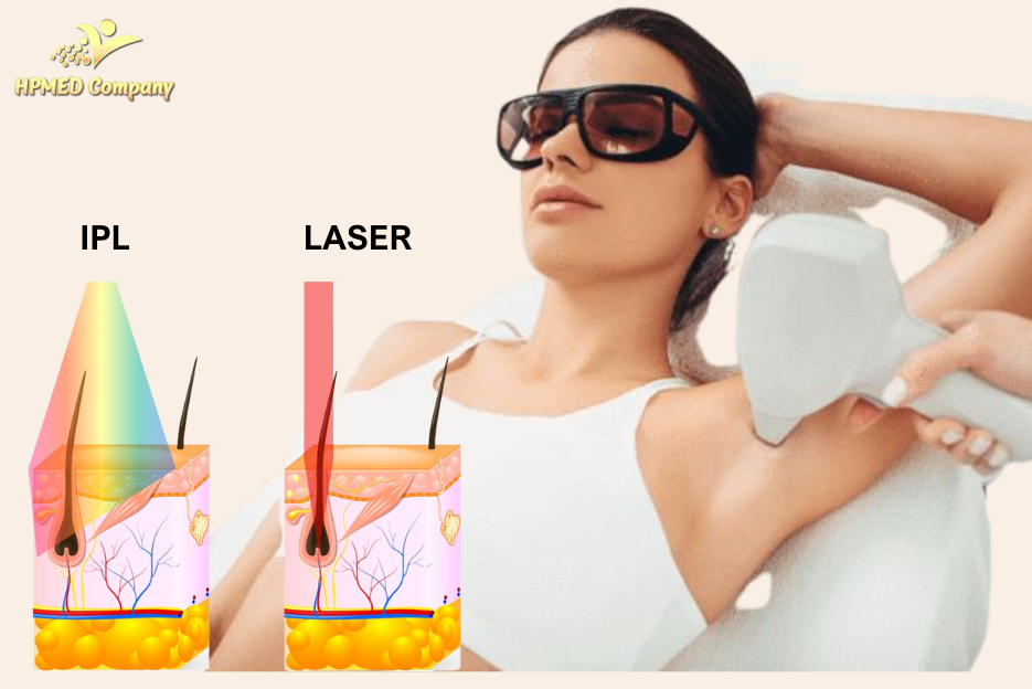 spa triệt lông là gì ? địa chỉ spa triệt lông nào tốt 3 Các phương pháp khác triệt long lại spa