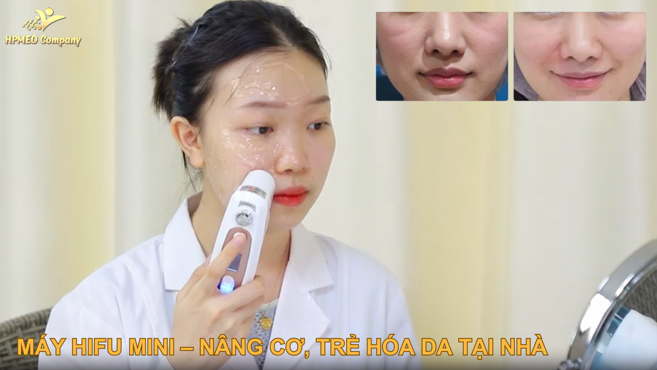 Máy HIFU Mini – Giải Pháp Nâng Cơ, Trẻ Hóa Da Tại Nhà Hiệu Quả 2025 1 Giới thiệu về máy HIFU mini