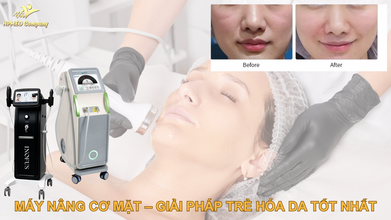 Máy nâng cơ mặt - giải pháp trẻ hóa da tốt nhất 2025 1 Máy nâng cơ mặt – giải pháp trẻ hóa da tốt nhất 2025