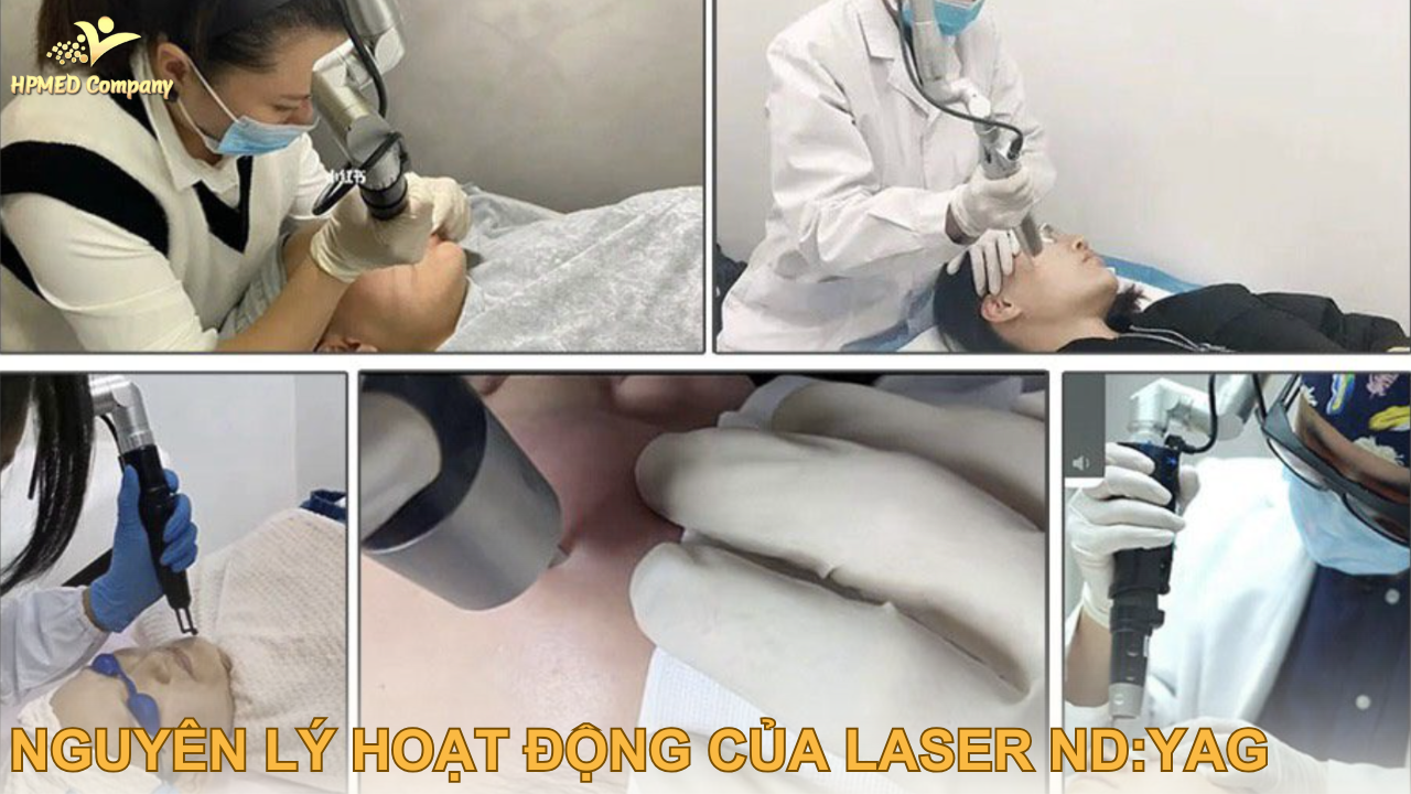 Nguyên lý hoạt động của laser nd yag ? 1 Nguyên lý hoạt động của laser nd yag ?