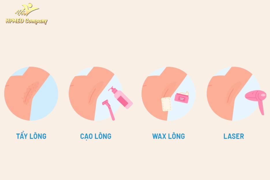 Các phương pháp triệt lông nách phổ biến
