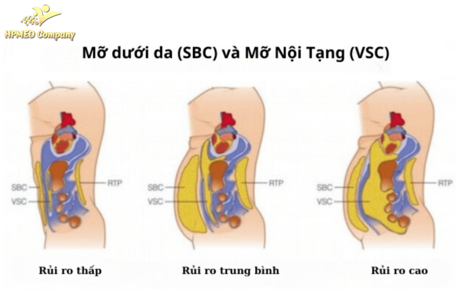 cách đào thải mỡ nội tạng nào hiệu quả an toàn 3 Cách nhận biết lượng mỡ nội tạng trong cơ thể