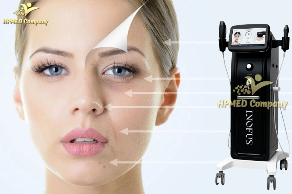 Máy Xóa Nhăn Công nghệ HIFU Máy Xóa Nhăn Công nghệ HIFU