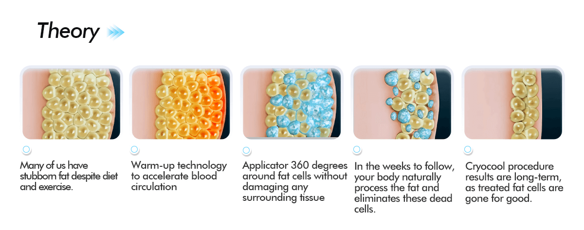 MÁY GIẢM BÉO QUANG ĐÔNG 360 Cryolipolysis SANHE - 05