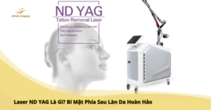 Laser ND YAG Là Gì? Bí Mật Phía Sau Làn Da Hoàn Hảo
