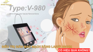 Điều Trị Giãn Mao Mạch Bằng Laser 980nm Có Hiệu Quả Không?