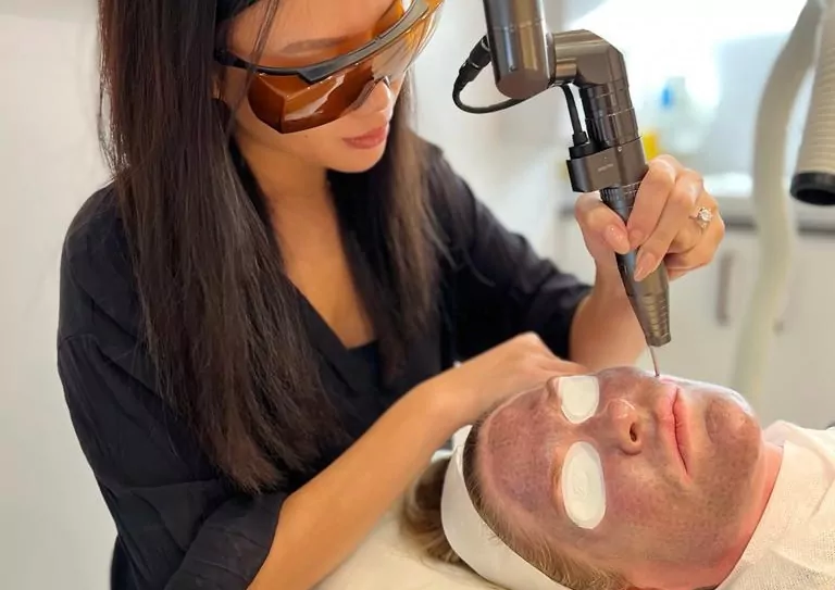 Giới thiệu về Laser Toning 1 Giới thiệu về Laser Toning