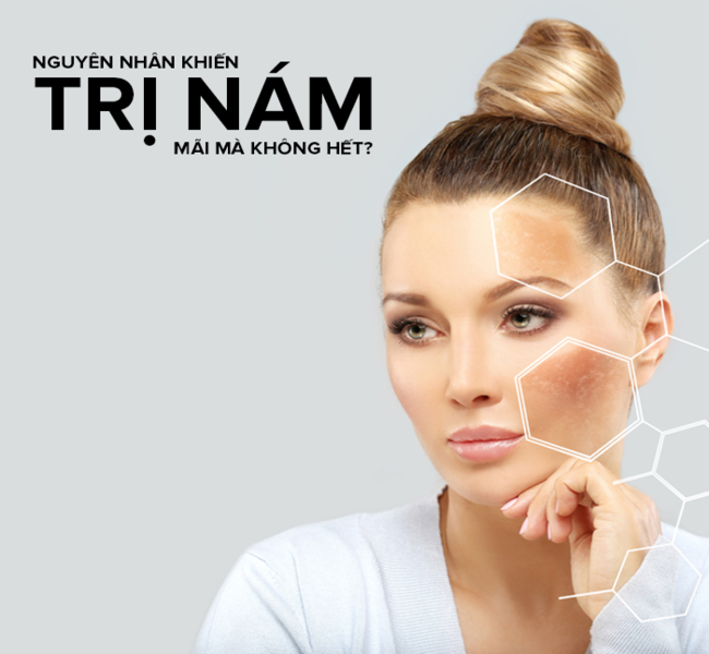 Phác đồ điều trị nám an toàn 3 Phác đồ điều trị nám an toàn