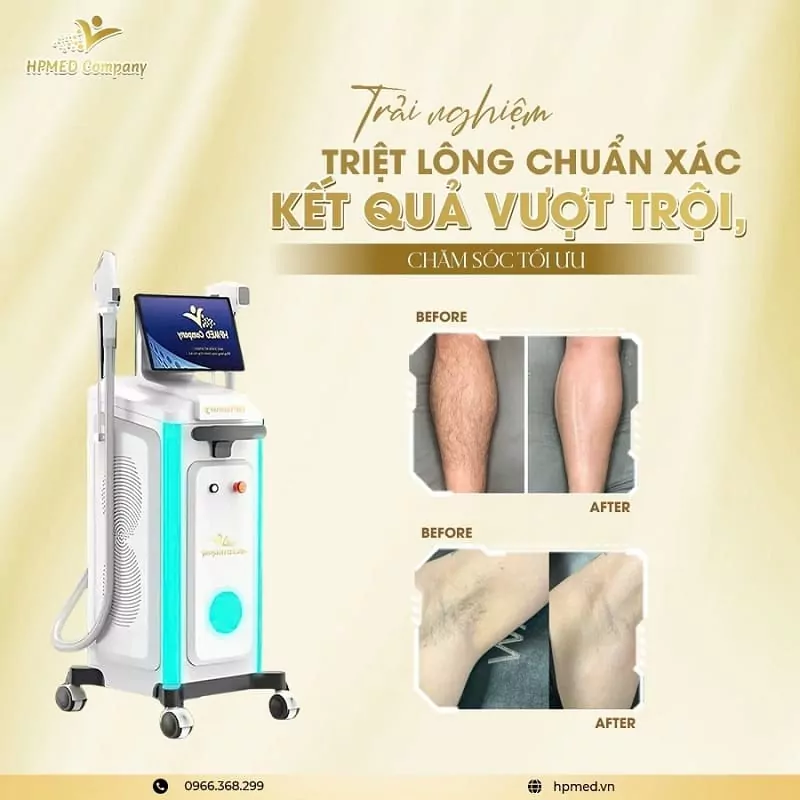 Máy Triệt Lông Diode Laser Cao Cấp