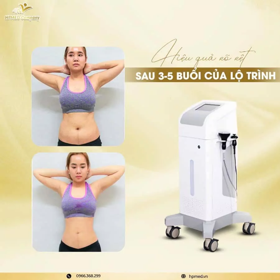 Máy Giảm Béo Cavitation RF BL H10 | Cao Cấp Thượng Hải