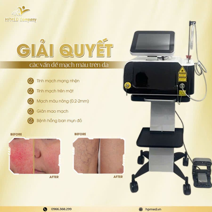 Máy Laser 980nm điều trị mạch máu trên da HPMED kèm hình ảnh trước sau khi xóa giãn mao mạch và đỏ da