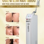 Sửa Chữa Máy Laser Co2 Fractional Tại Hưng Yên Kinh Nghiệm, Kiến Thức và Lời Khuyên