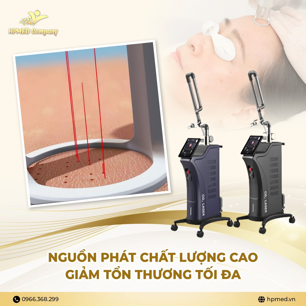 Sửa Chữa Máy Laser Co2 Fractional Tại Bình Dương Kinh Nghiệm, Chuyên Môn và Uy Tín