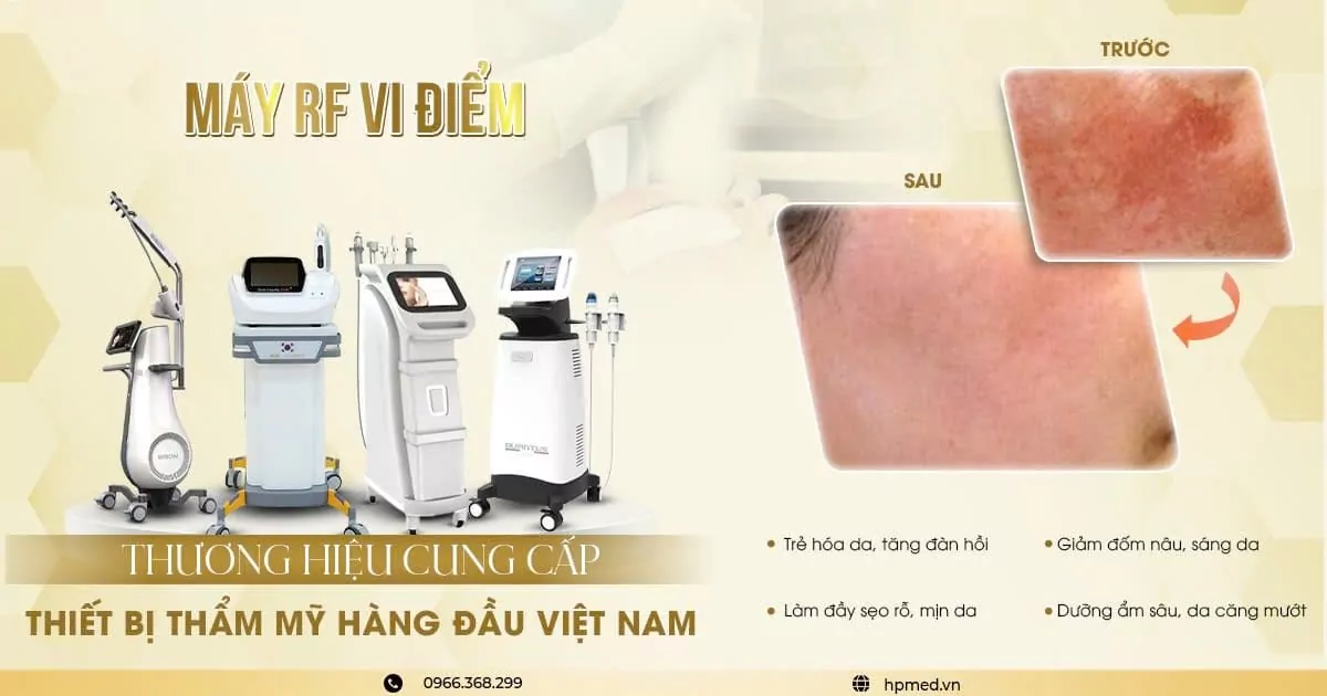 Máy RF vi điểm thẩm mỹ và hình ảnh so sánh da mặt trước sau điều trị giảm thâm nám, mịn da