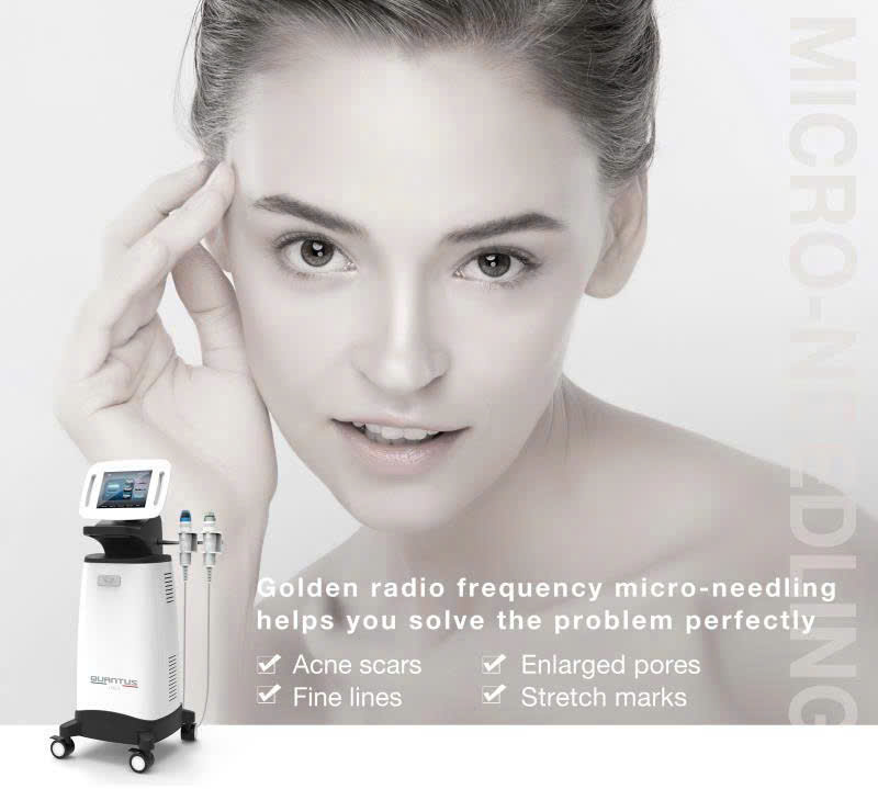 Máy RF Vi Kim Quanstu Cao Cấp Bắc Kinh