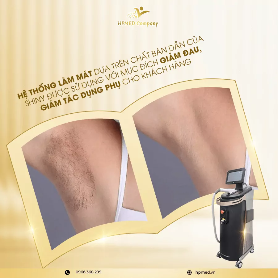 Máy Triệt Lông Shiny Plus Hàn Quốc 🌸 Công Nghệ IPL Đa Năng – Triệt Lông Êm Ái, Trẻ Hóa Da Hiệu Quả