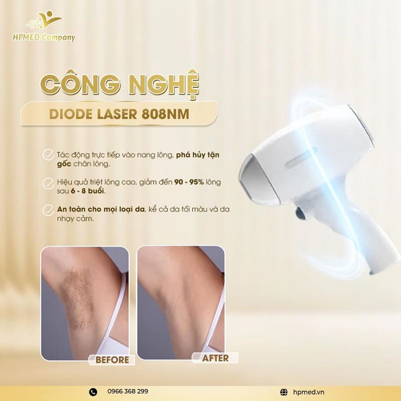 Máy Triệt Lông Diode Laser Cao Cấp