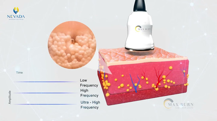 Sửa Chữa Máy Giảm Béo Tại Lạng Sơn