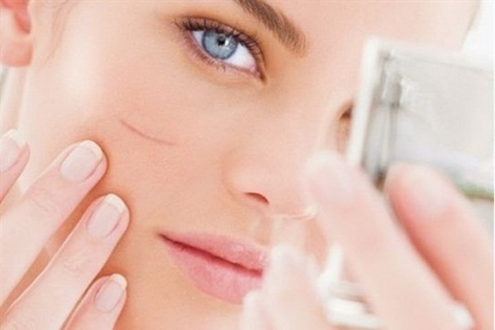 Sửa Máy Điều Trị Sẹo - Tối Ưu Chi Phí và Thời Gian Số 1 2 Sửa Máy Điều Trị Sẹo - Tối Ưu Chi Phí và Thời Gian